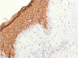 Cytokeratin 10 Antibody (KRT10/1948R) - Azide and BSA Free, Novus Biologicals 100 &mu;g | Buy Online | Novus Biologicals | Fisher Scientific